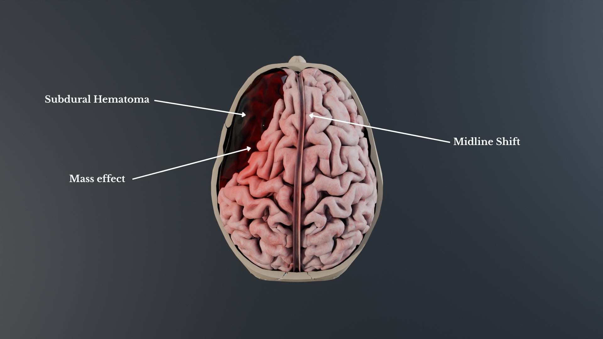 transverse-view